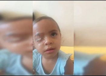 Menina de 2 anos vai parar no hospital após grudar olho com cola