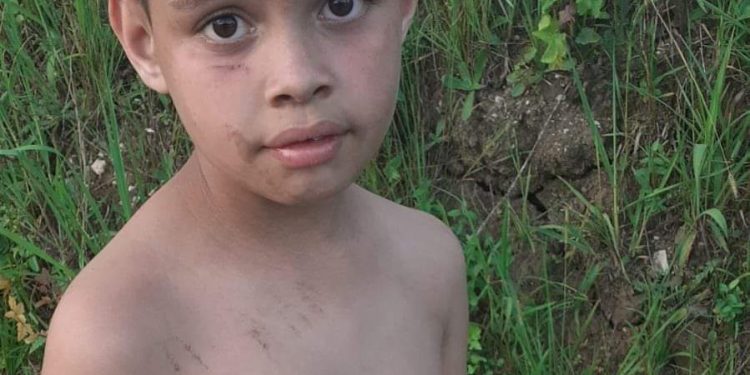 MENINO QUE FUGIU DE CASA DE PASSAGEM EM ALMIRANTE TAMANDARÉ AINDA NÃO FOI ENCONTRADO