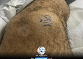 🗣 HOMEM ESCREVE “SIM” E “NÃO” NOS JOELHOS PARA EVITAR ERRO EM CIRURGIA 🗣