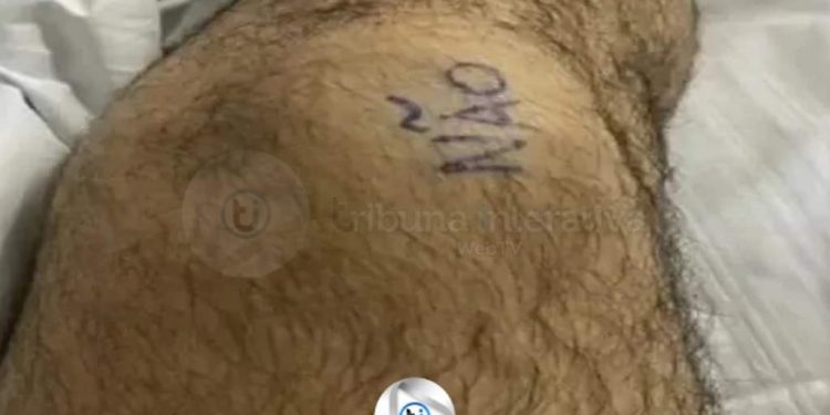 🗣 HOMEM ESCREVE “SIM” E “NÃO” NOS JOELHOS PARA EVITAR ERRO EM CIRURGIA 🗣