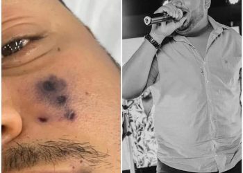 CANTOR DE FORRÓ MORRE APÓS SER PICADO POR ARANHA E ROSTO COMEÇAR A ESCURECER