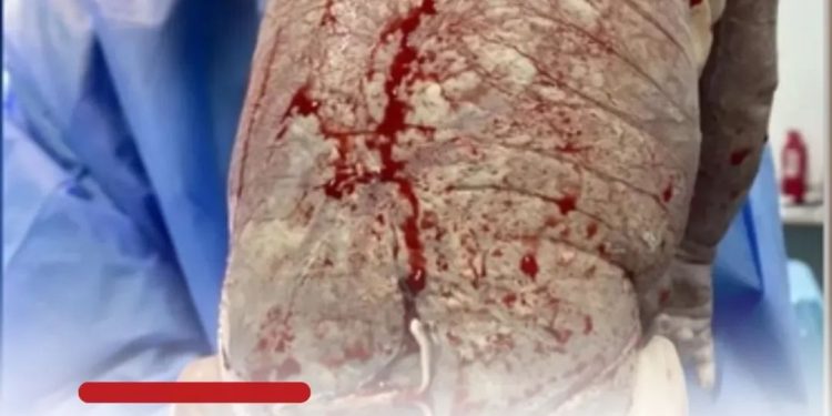 Bebê nas com DIU colado no corpo