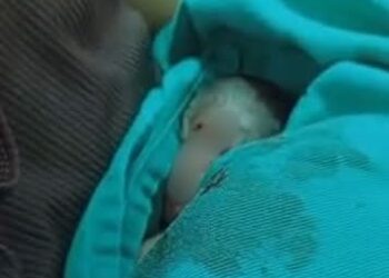 Bebê que havia “renascido” após ser dado como morto morre dois dias depois