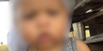 Bebê de 1 ano e 8 meses foi picado por uma cobra da espécie Bothrops jararaca